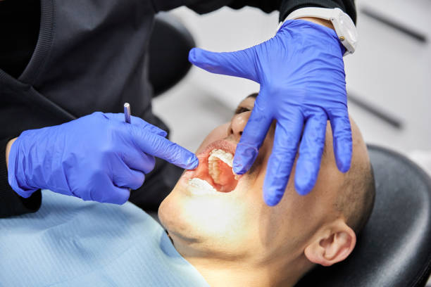Best Broken or Cracked Tooth Emergency Dentist in Rollingwood, TX